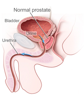 normal prostate